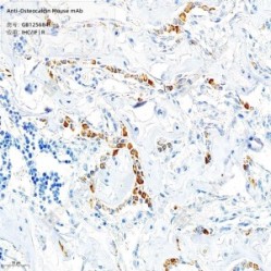 Anti-Osteocalcin Mouse mAb - 100 µL