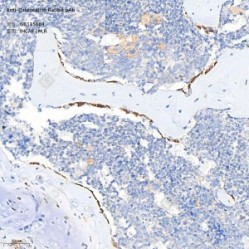 Anti-Osteocalcin Rabbit pAb - 50 µL