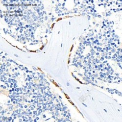 Anti-Osteocalcin Rabbit pAb - 50 µL