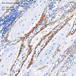 Anti-Osteocalcin Rabbit pAb - 50 µL