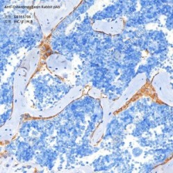 Anti-Osteoprotegerin Rabbit pAb - 50 µL