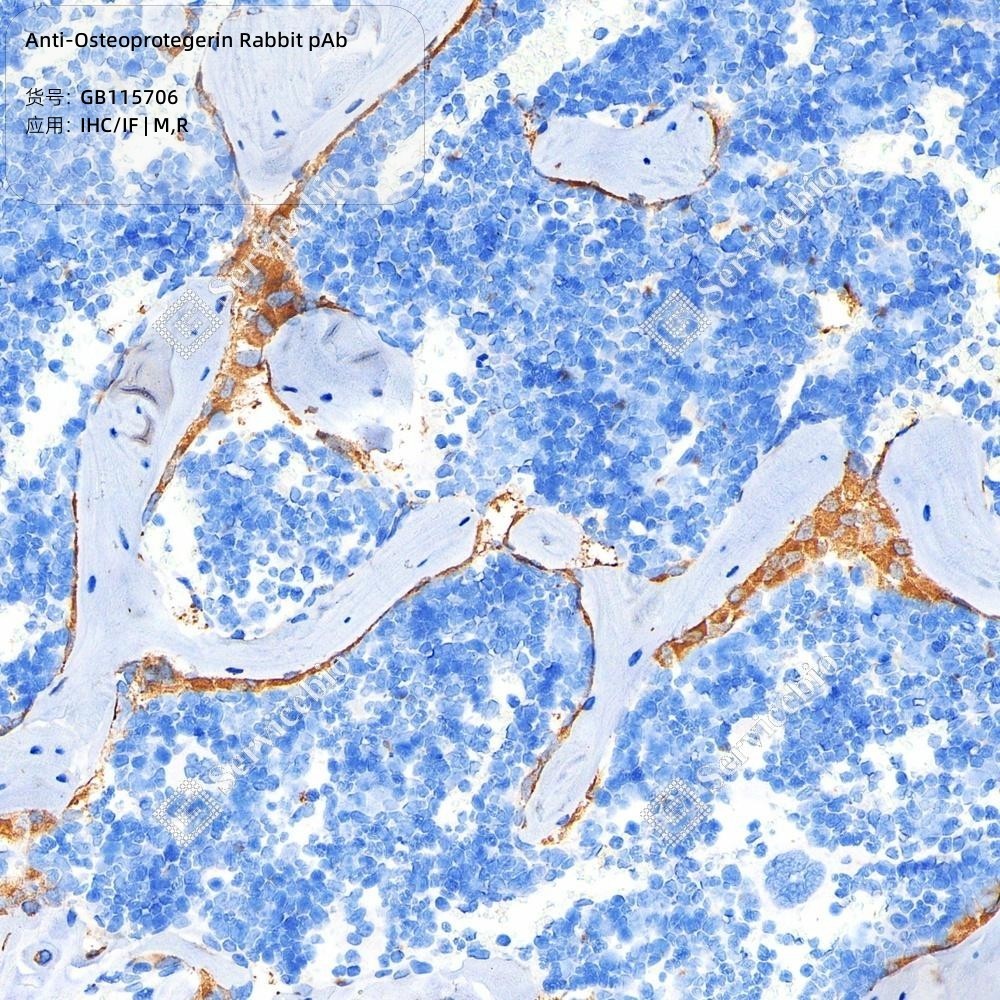 Anti-Osteoprotegerin Rabbit pAb - 50 µL