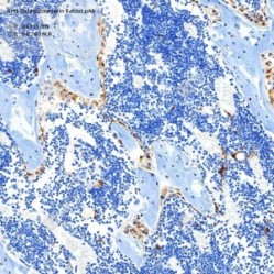Anti-Osteoprotegerin Rabbit pAb - 100 µL