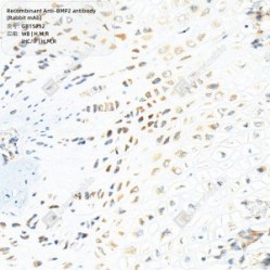 Recombinant Anti-BMP2 antibody (Rabbit mAb) - 100 µL