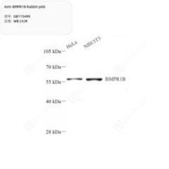 Anti-BMPR1B Rabbit pAb - 50 µL