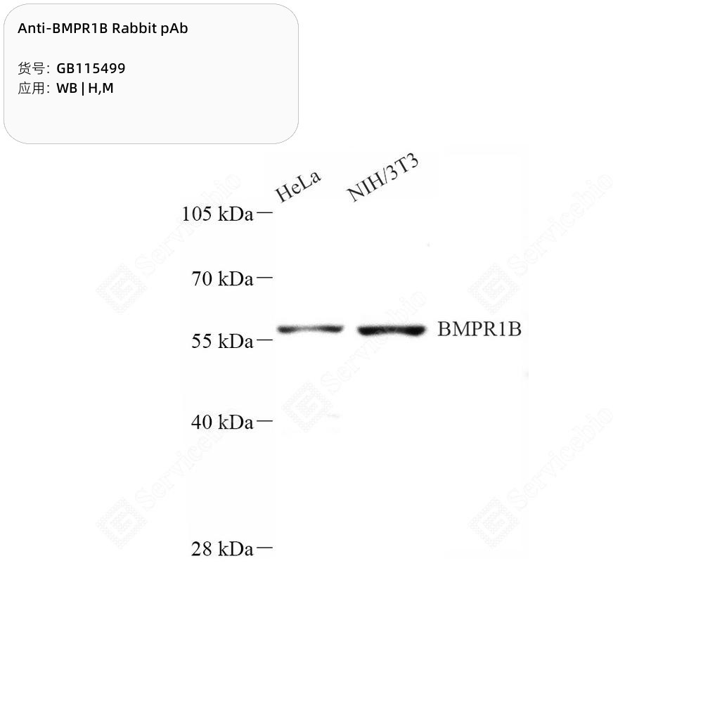 Anti-BMPR1B Rabbit pAb - 50 µL