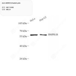 Anti-BMPR1B Rabbit pAb - 50 µL