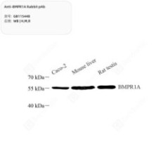 Anti-BMPR1A Rabbit pAb - 50 µL