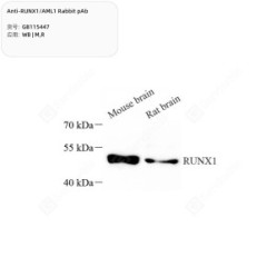 Anti-RUNX1/AML1 Rabbit pAb - 50 µL