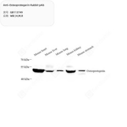 Anti-Osteoprotegerin Rabbit pAb - 50 µL