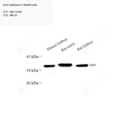 Anti-Cathepsin V Rabbit pAb - 50 µL