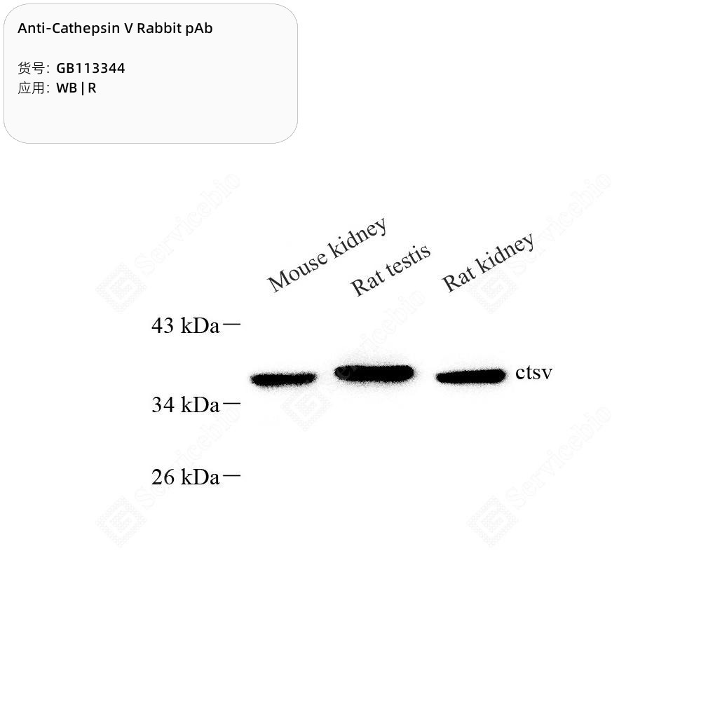Anti-Cathepsin V Rabbit pAb - 50 µL