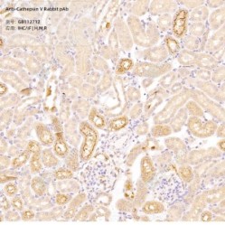Anti-Cathepsin V Rabbit pAb - 50 µL