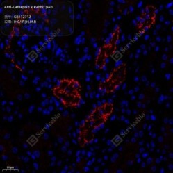 Anti-Cathepsin V Rabbit pAb - 50 µL