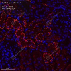 Anti-Cathepsin V Rabbit pAb - 50 µL