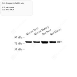 Anti-Osteopontin Rabbit pAb - 50 µL