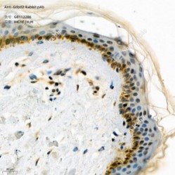 Anti-Gdpd2 Rabbit pAb - 50 µL