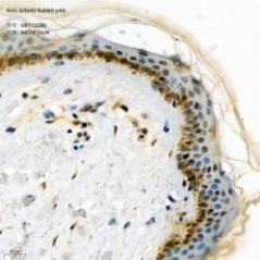 Anti-Gdpd2 Rabbit pAb - 50 µL