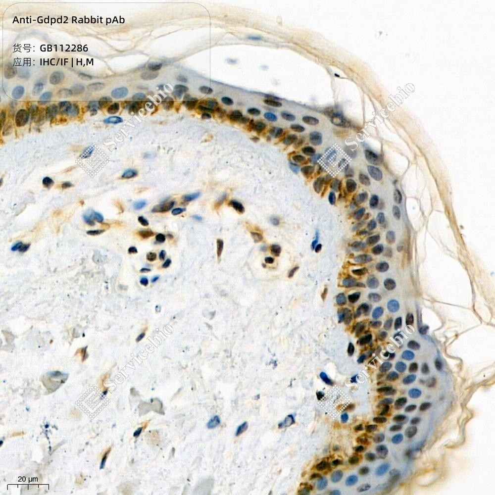 Anti-Gdpd2 Rabbit pAb - 50 µL