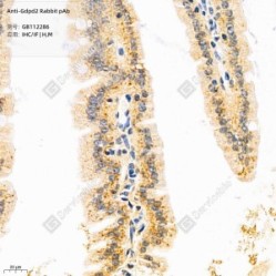 Anti-Gdpd2 Rabbit pAb - 50 µL