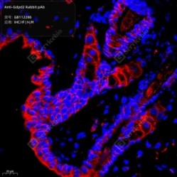 Anti-Gdpd2 Rabbit pAb - 50 µL