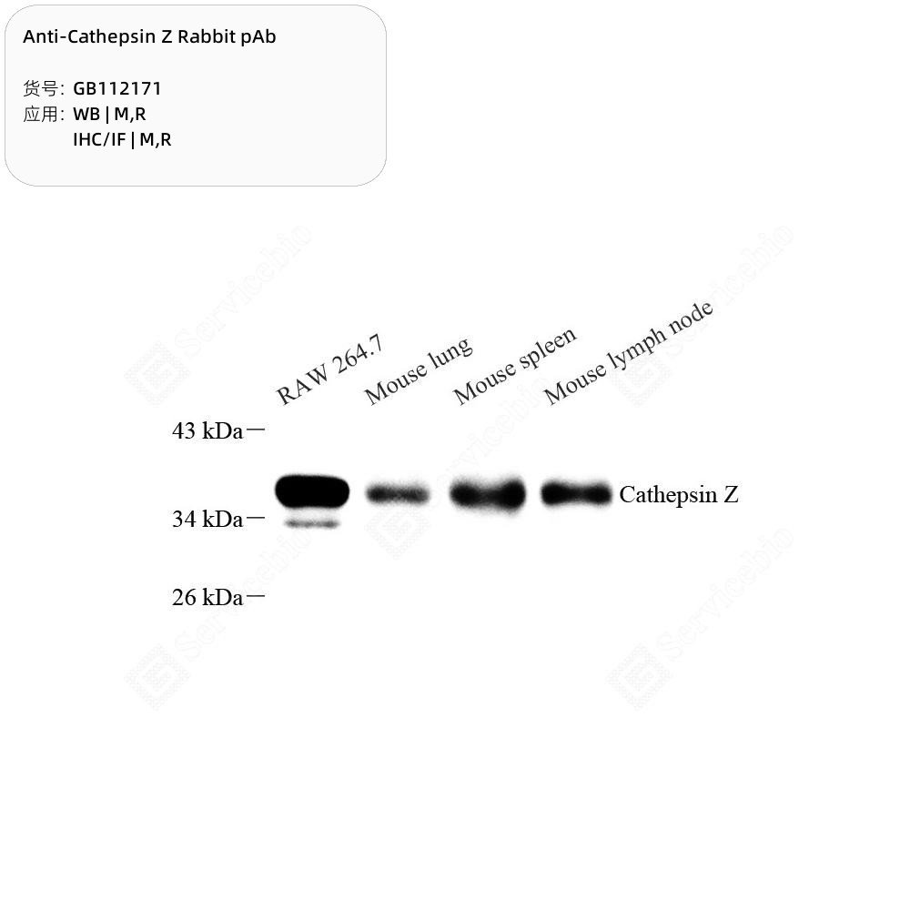 Anti-Cathepsin Z Rabbit pAb - 50 µL