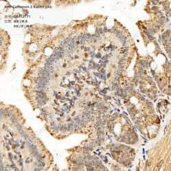 Anti-Cathepsin Z Rabbit pAb - 50 µL