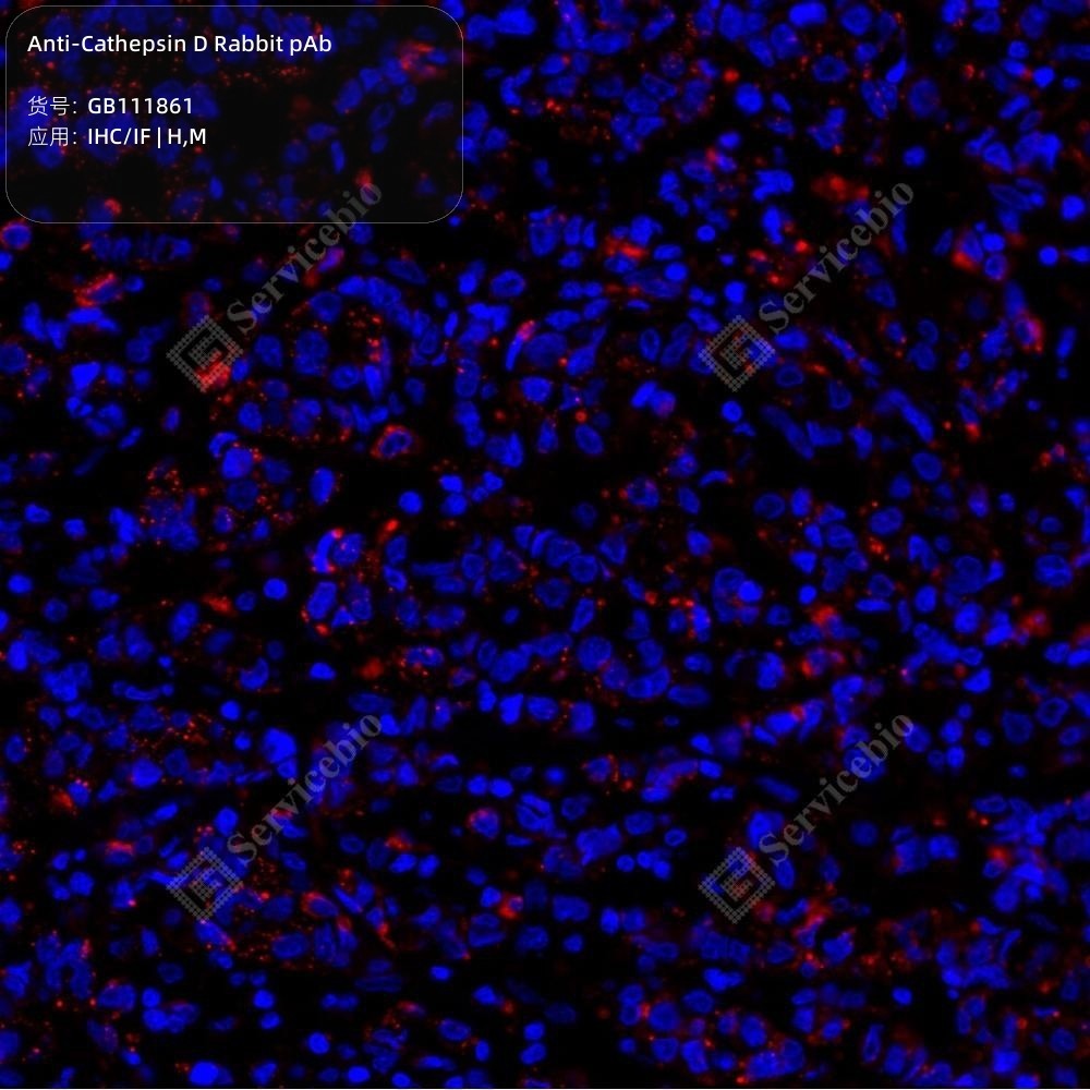 Anti-Cathepsin D Rabbit pAb - 50 µL
