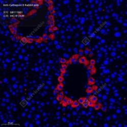 Anti-Cathepsin D Rabbit pAb - 50 µL