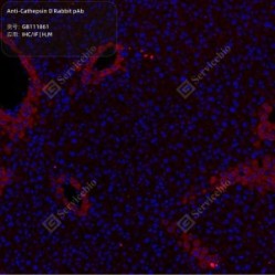 Anti-Cathepsin D Rabbit pAb - 50 µL
