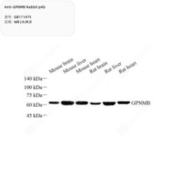 Anti-GPNMB Rabbit pAb - 50 µL