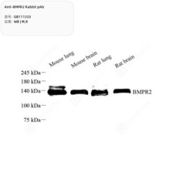 Anti-BMPR2 Rabbit pAb - 50 µL