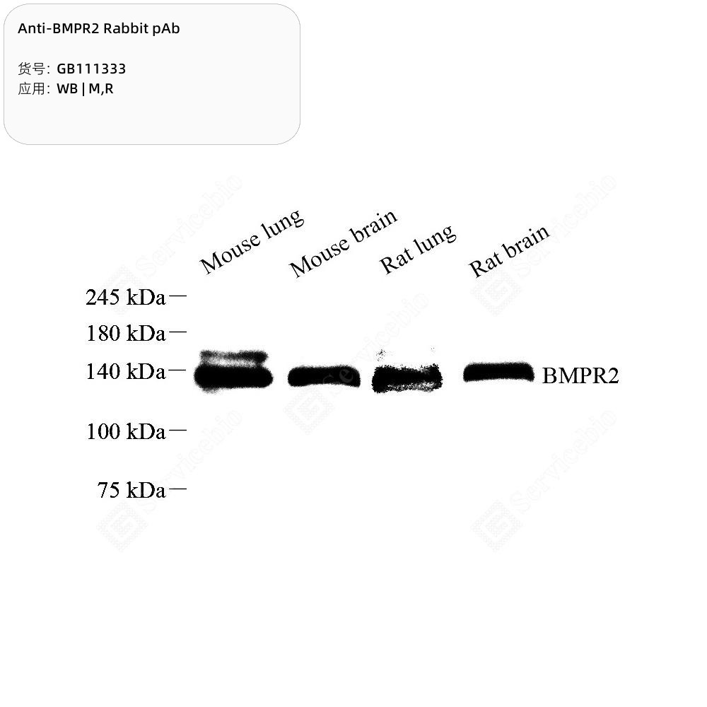 Anti-BMPR2 Rabbit pAb - 50 µL