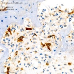 Anti-Cathepsin K Rabbit pAb - 50 µL