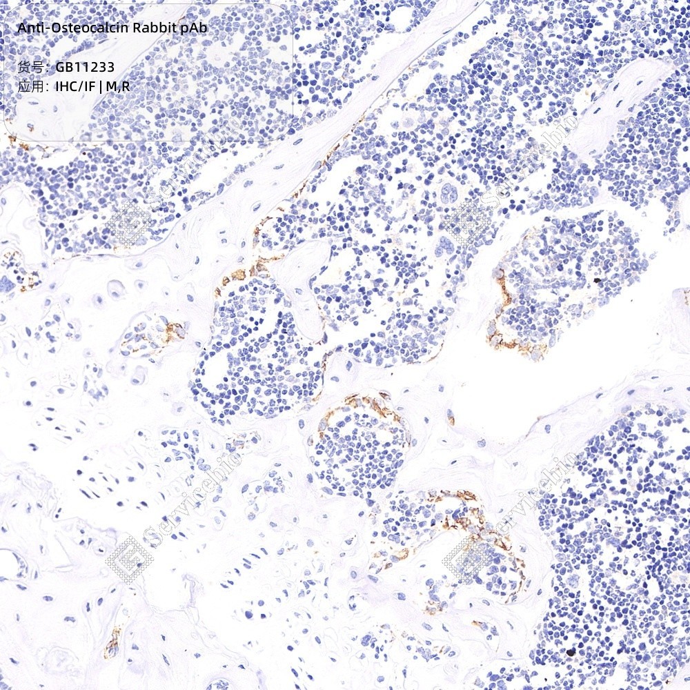 Anti-Osteocalcin Rabbit pAb - 50 µL