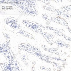Anti-Osteocalcin Rabbit pAb - 50 µL