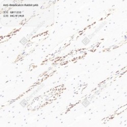Anti-Osteocalcin Rabbit pAb - 50 µL