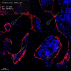 Anti-Osteocalcin Rabbit pAb - 50 µL
