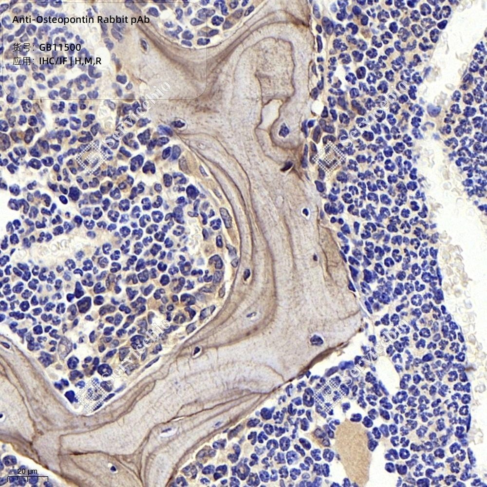 Anti-Osteopontin Rabbit pAb - 50 µL