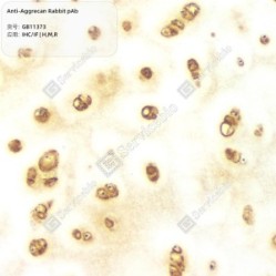 Anti-Aggrecan Rabbit pAb - 50 µL