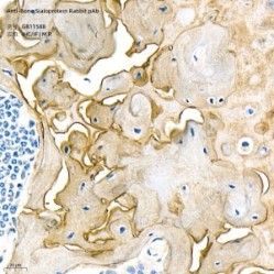 Anti-Bone Sialoprotein Rabbit pAb - 50 µL