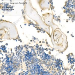 Anti-Bone Sialoprotein Rabbit pAb - 50 µL