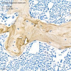 Anti-Bone Sialoprotein Rabbit pAb - 50 µL
