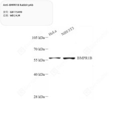 Anti-BMPR1B Rabbit pAb - 100 µL