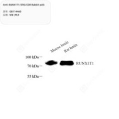 Anti-RUNX1T1/ETO/CDR Rabbit...