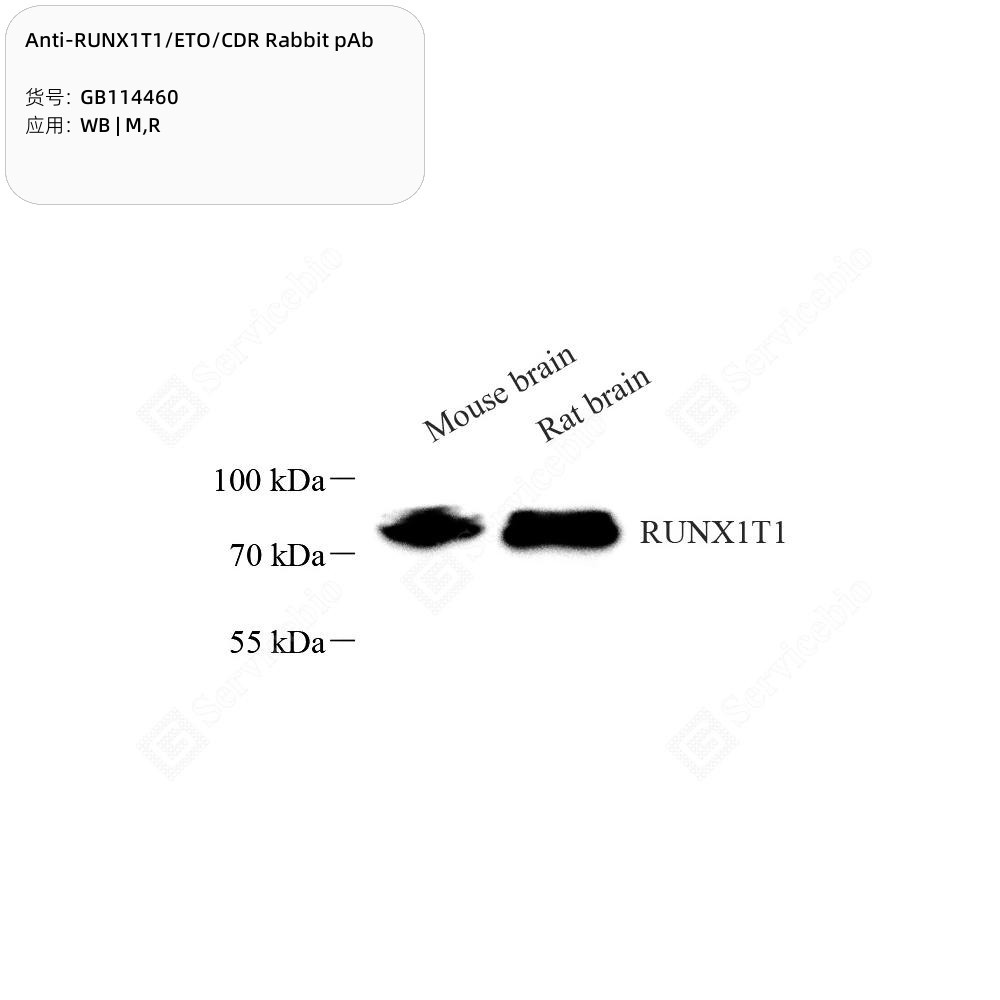 Anti-RUNX1T1/ETO/CDR Rabbit pAb - 100 µL