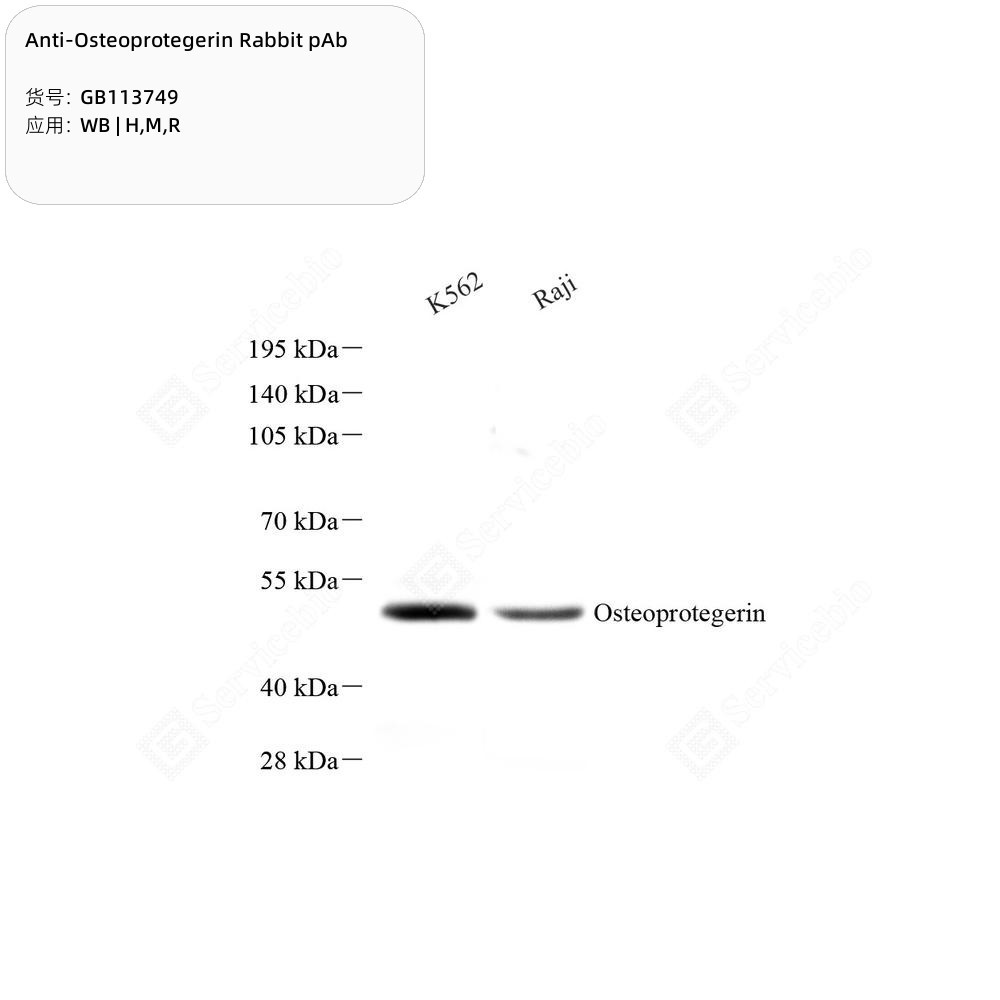 Anti-Osteoprotegerin Rabbit pAb - 100 µL