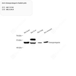 Anti-Osteoprotegerin Rabbit pAb - 100 µL