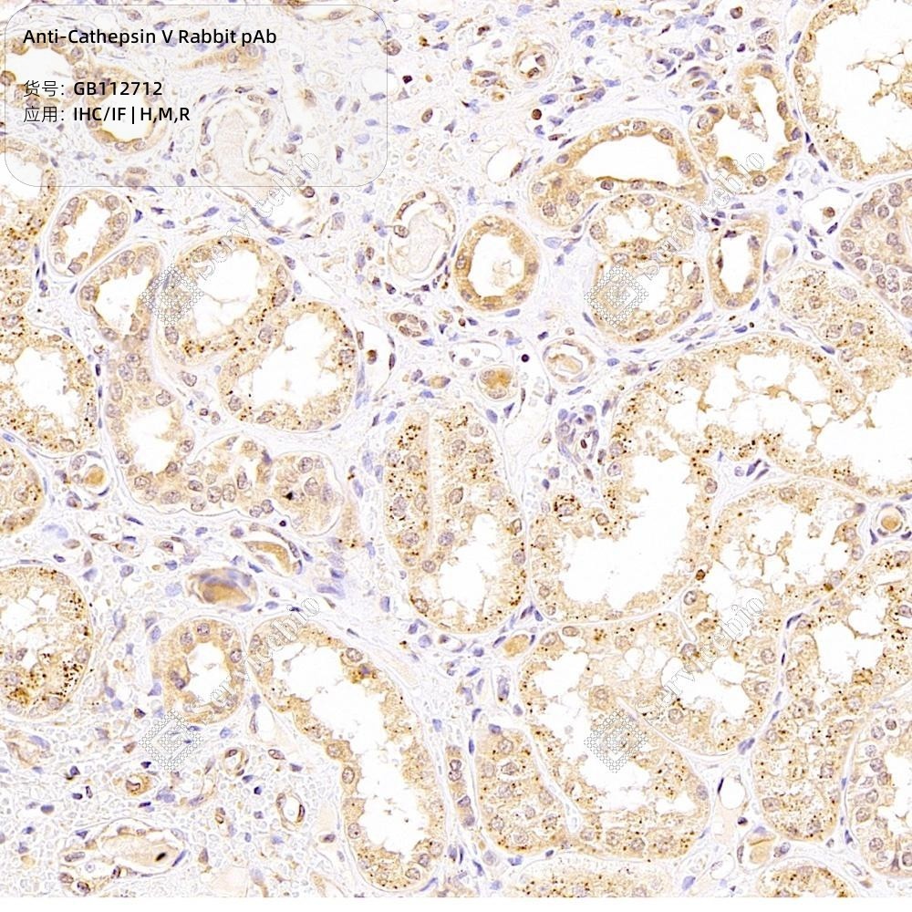 Anti-Cathepsin V Rabbit pAb - 100 µL
