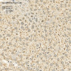 Anti-Cathepsin Z Rabbit pAb - 100 µL